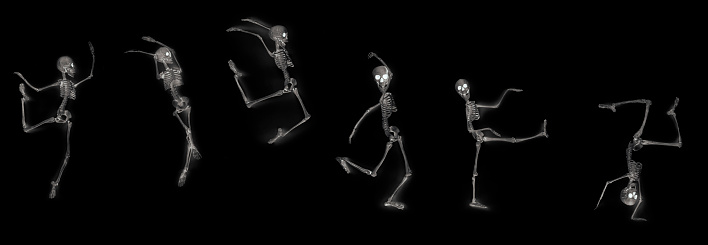 Silly dancing medical skeleton on xray machine
