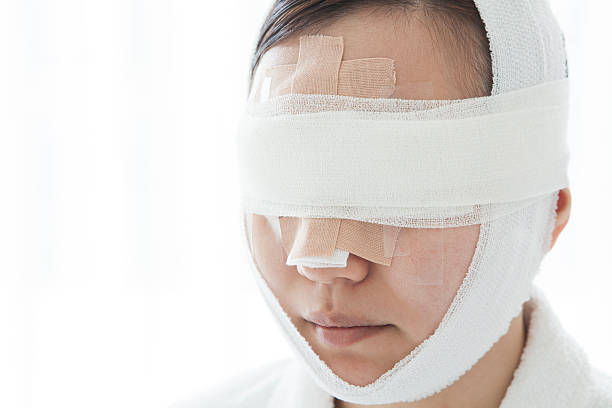 istock Young woman after cosmetic surgery 485365046