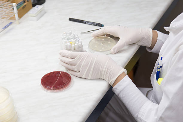의료 미생물 처리 연구소입니다. 세균 집락이 - mrsa blood agar surgical glove microbiology 뉴스 사진 이미지