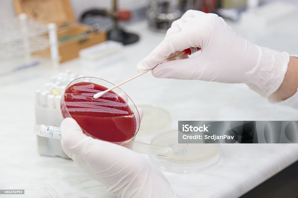 Medical el laboratorio de microbiología.  Las colonias de - Foto de stock de Estafilococo áureo resistente a los antibióticos libre de derechos