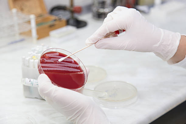의료 미생물 처리 연구소입니다. 세균 집락이 - mrsa blood agar surgical glove microbiology 뉴스 사진 이미지