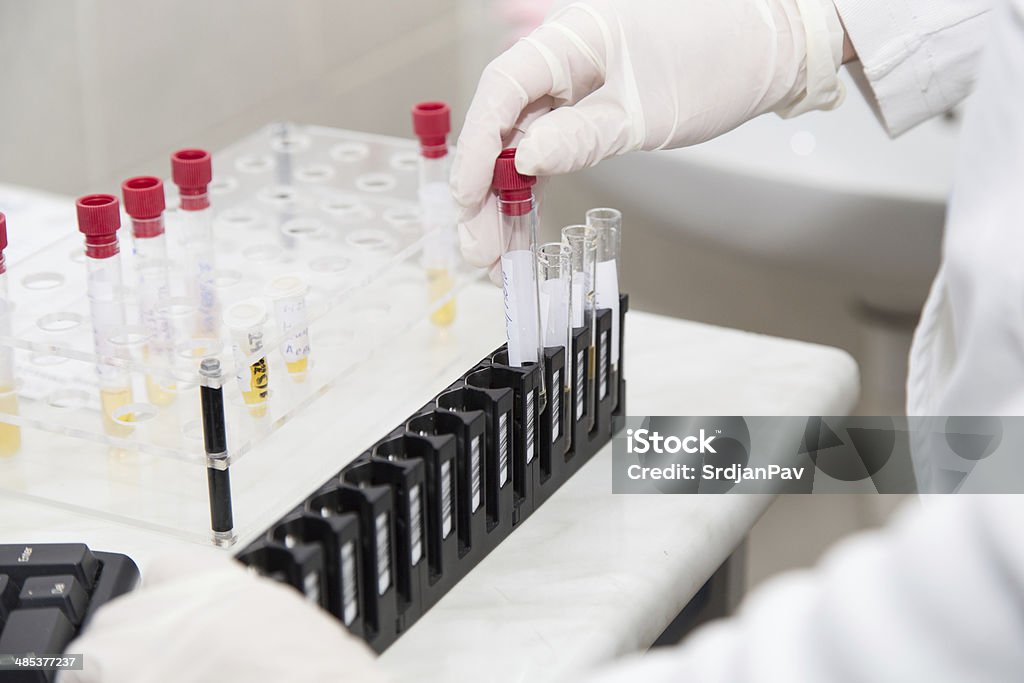 Tubo de ensayo s'está preparando para algunas pruebas - Foto de stock de Agar sangre libre de derechos