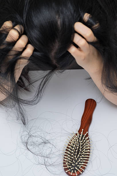 woman hair loss problem woman hair loss problem , she stress  looking on her hair loss in her hand hairbrush hair stock pictures, royalty-free photos & images
