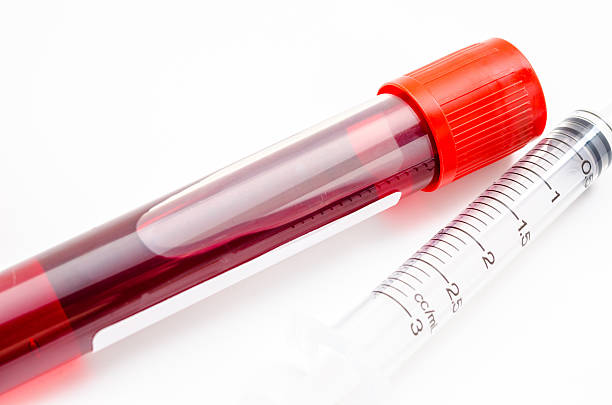 istock Blood sample in tube blood for screening test 486021614