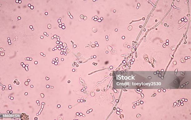 Infeksi Ragi Sel Ragi Pemula Dengan Pseudohyphae Foto Stok - Unduh Gambar Sekarang ...
