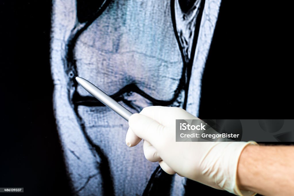 Medizin Arzt zeigt auf radiograph x-ray Bild! - Lizenzfrei Analysieren Stock-Foto