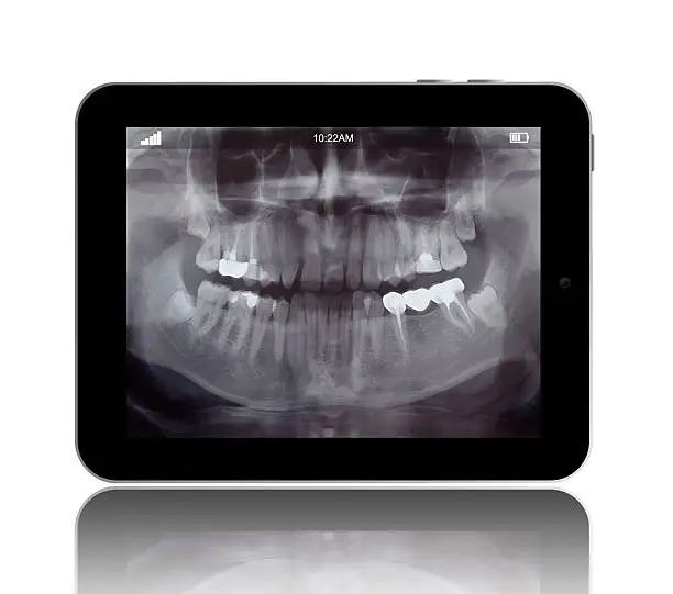 Photo of Human Teeths X-ray on the Digital Tablet