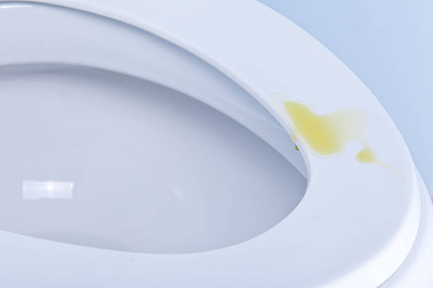 istock toilet seat splattered with urine 486469231