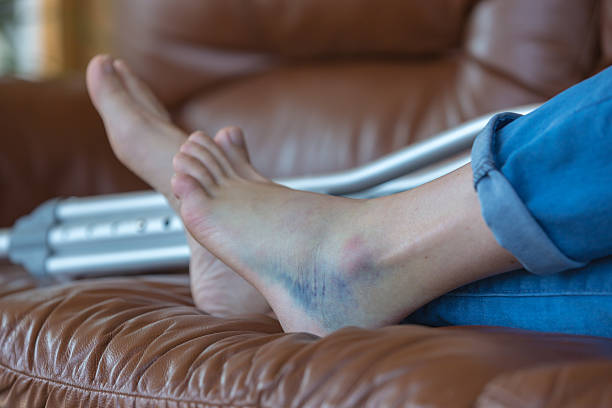 istock Injured Woman Walking With Crutches 486504146