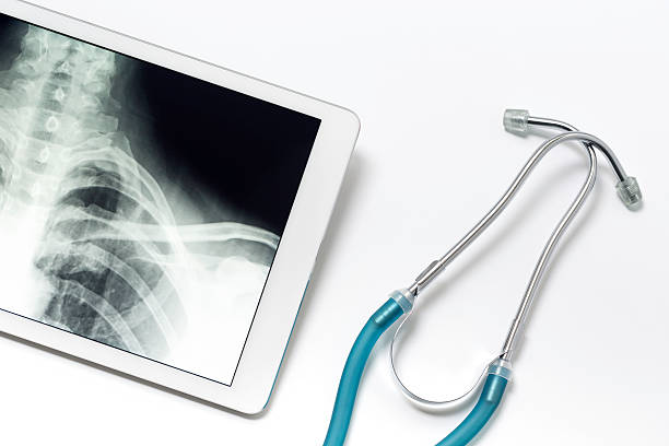 디지털 태블릿 표시중 x-레이 이미지 - digital tablet doctor note pad x ray image 뉴스 사진 이미지