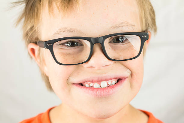 istock The Face of Downs Syndrome 486527342