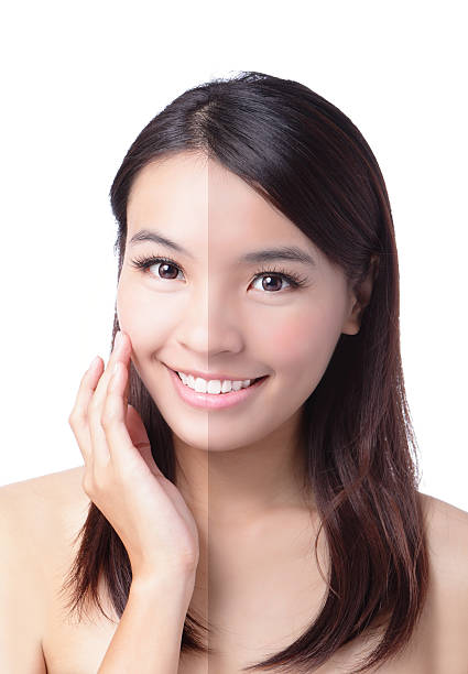 istock Woman face with half tan skin (before and after) 486548539