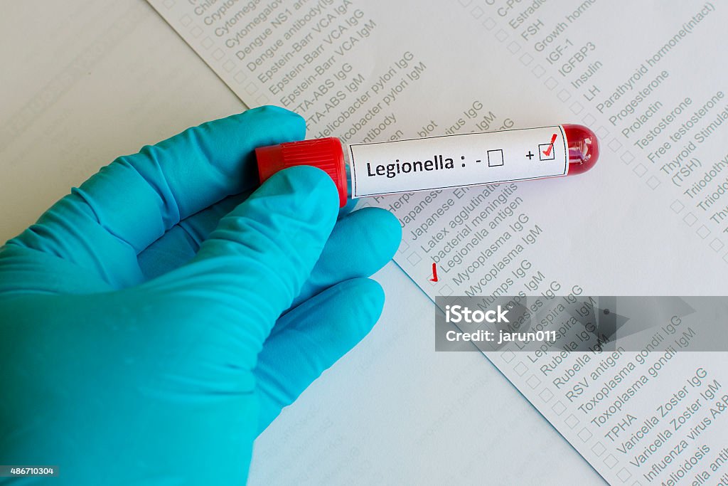 Legionella positive Blood sample with legionella positive Legionella Pneumophila Stock Photo