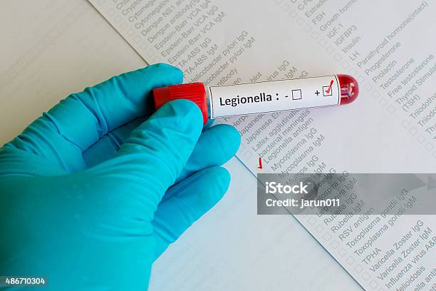 Legionella Positive Stock Photo - Download Image Now - Legionella Pneumophila, Bacterium, Medical Test