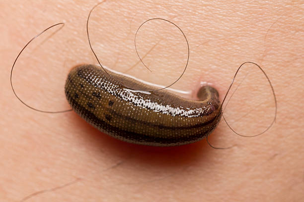 Bloodsucking Leech Stock Photo - Download Image Now - Leech, 2015, Activity - iStock Bloodsucking Leech Stock Photo - Download Image Now - Leech, 2015, Activity - iStock