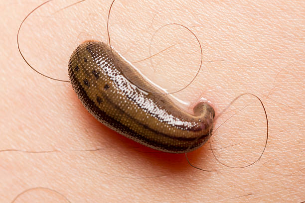 20+ Leech Annelid Human Skin Worm Stock Photos, Pictures & Royalty-Free  Images - iStock