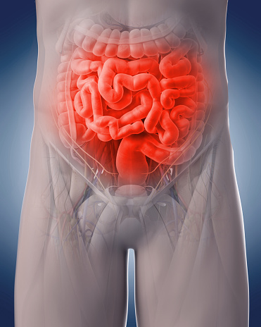 medical 3d illustration of a painful intestine