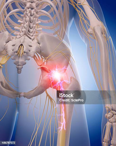 Medical Illustration Stock Photo - Download Image Now - Sciatic Nerve, Pain, Anatomy