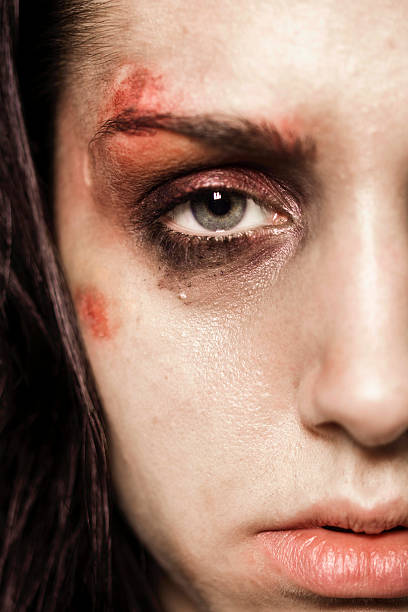 istock Beaten up girl close-up half 486790921