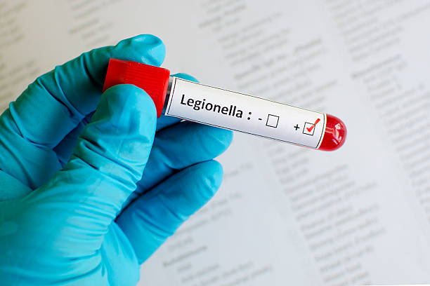 Legionella positive stock photo