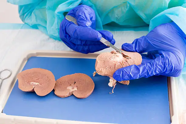 Medical student in anatomy class dissecting a sheep kidney working with a whole kidney looking at the irater and capsule, and also a cross section showing the internal tissue structure, close up