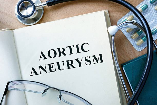 istock Aortic aneurysm concept. Book with stethoscope and pills. 487002500