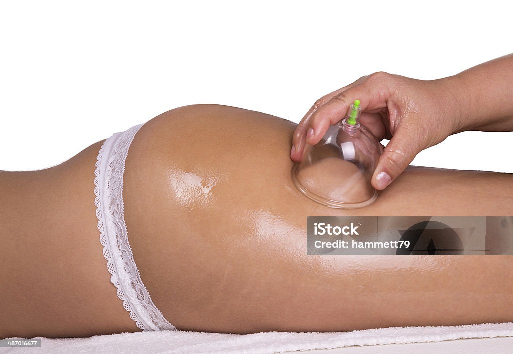 Cupping therapy Caucasian female laying and get a cupping therapy Vacuum Cupping Stock Photo