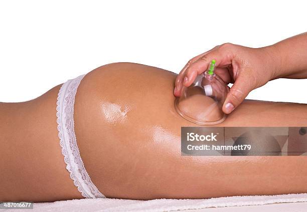 Cupping Therapy Stock Photo - Download Image Now - Vacuum Cupping, Acupuncture, Adult