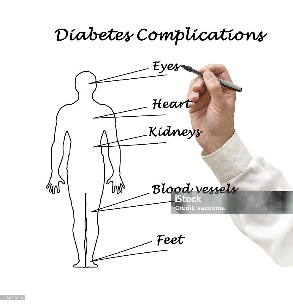 Los factores de riesgo para la Diabetes - Foto de stock de Adulto libre de derechos