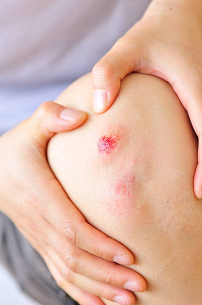istock sports injured knee 487124163
