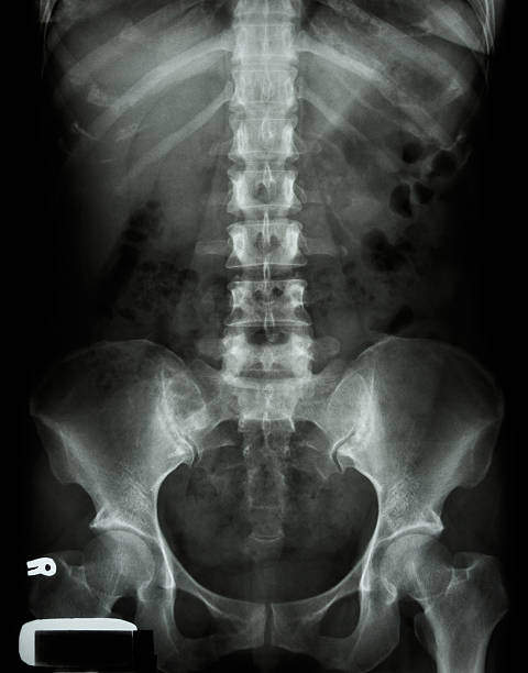x-ray lumbo-крестцовый отдел позвоночника и таза азиатских взрослый человек - human spine human bone human vertebra rib cage стоковые фото и изображения