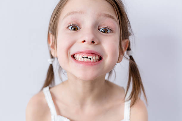 Close up portrait of preschooler girl with molars Close up portrait of preschooler girl with open mouth without milk tooth baby teeth stock pictures, royalty-free photos & images
