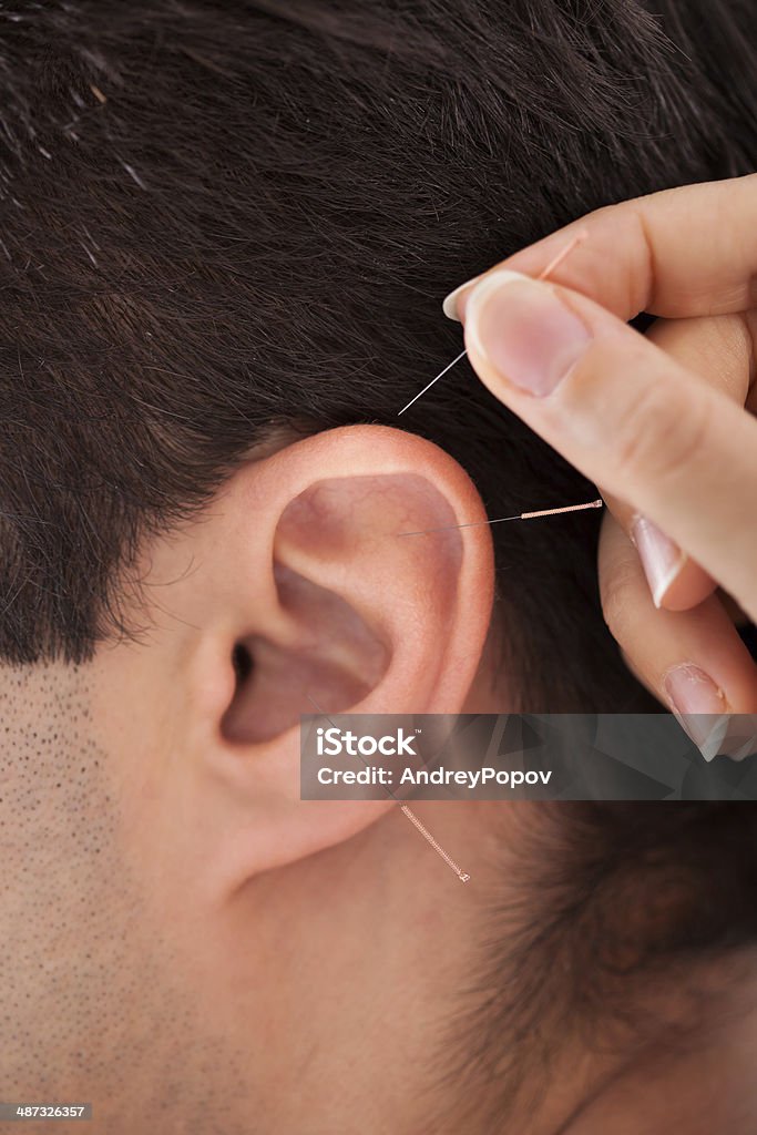 Persona de retención de la aguja cerca de oreja - Foto de stock de Acupuntura libre de derechos