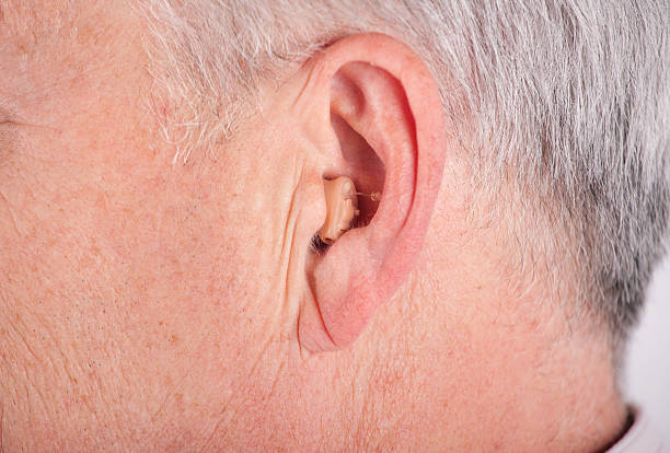 senior mit cic hörgerät - hearing aid audiologist audiology small stock-fotos und bilder