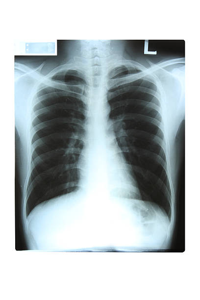 x-ray - libs foto e immagini stock