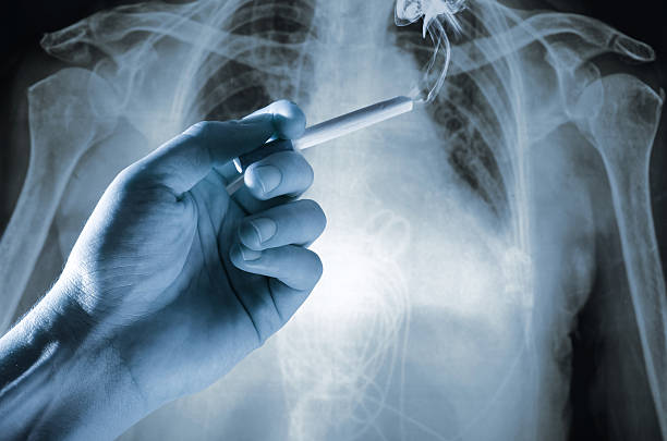 Hand in front of the x ray image Hand with a cigarette in front of the x ray image of human abdomen female rib cage stock pictures, royalty-free photos & images