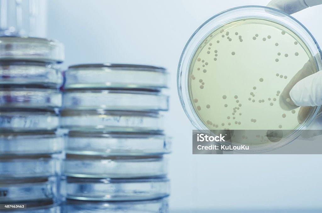 Ágar Prato cheio de micro bacterias e microorganismos - Foto de stock de Legionela royalty-free