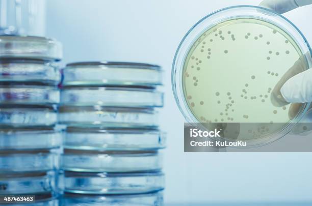 Ágar Prato Cheio De Micro Bacterias E Microrganismos - Fotografias de stock e mais imagens de Legionela