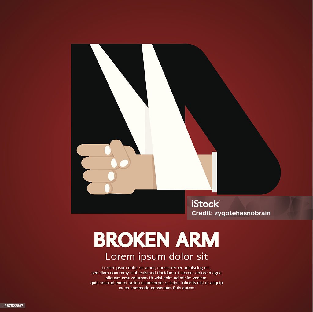 Broken Arm Broken Arm Vector Illustration Adult stock vector