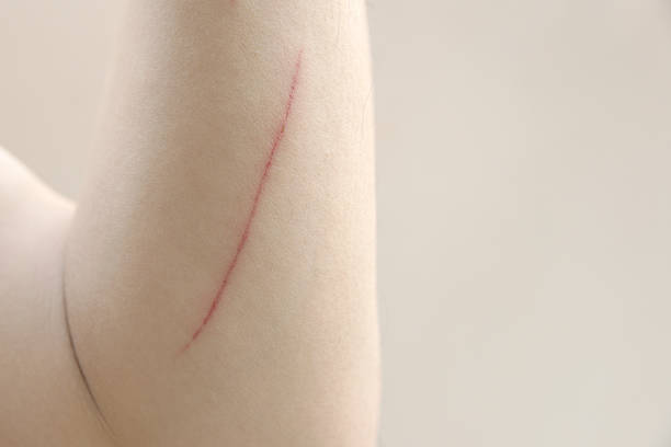 Scratched arm Red scratched arm over white background scab arm stock pictures, royalty-free photos & images