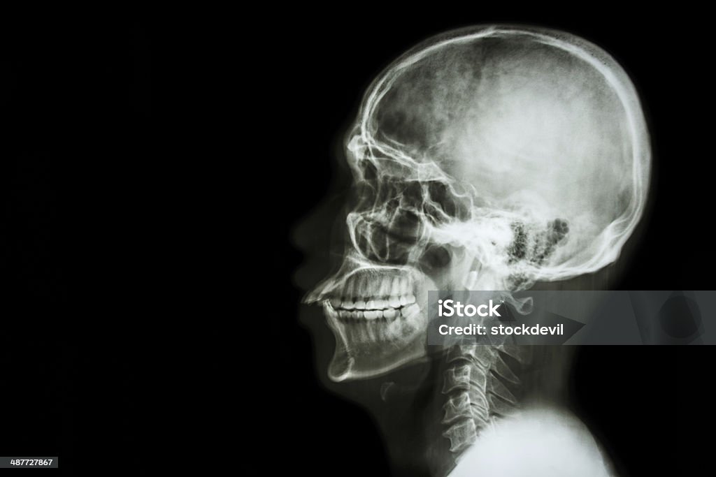 X-ray asian skull and blank area at left side Letter X Stock Photo