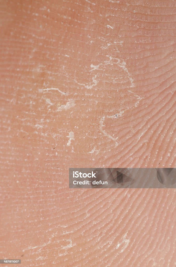 Suchość skóry Tekstura - Zbiór zdjęć royalty-free (Abstrakcja)