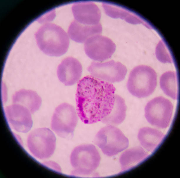 istock blood films for Malaria parasite. 488148728