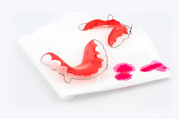 istock Removable brace retainer on napkin with blood 488213990
