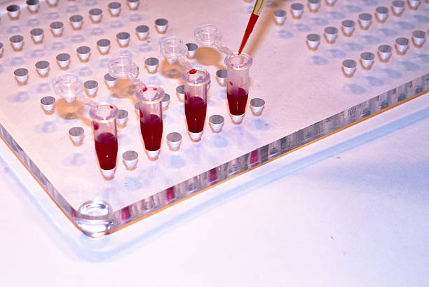istock In medical laboratories studied blood. 488221718