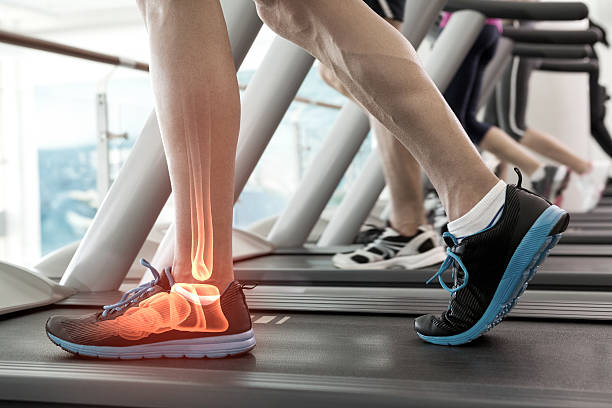 istock Highlighted bones of man on treadmill 488466220