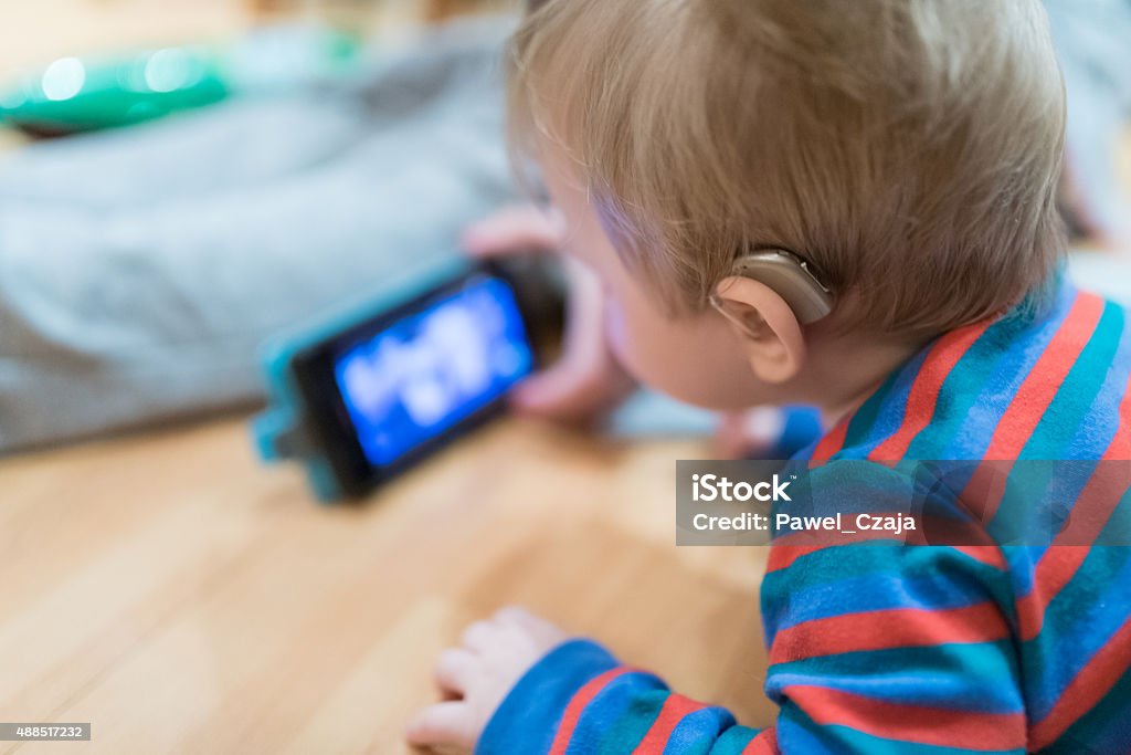 Close up on hearing aid weared by baby Disability Stock Photo