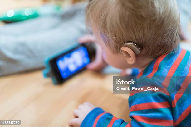 Close Up On Hearing Aid Weared By Baby Stock Photo - Download Image Now - Disability, Hearing Aid, Baby - Human Age