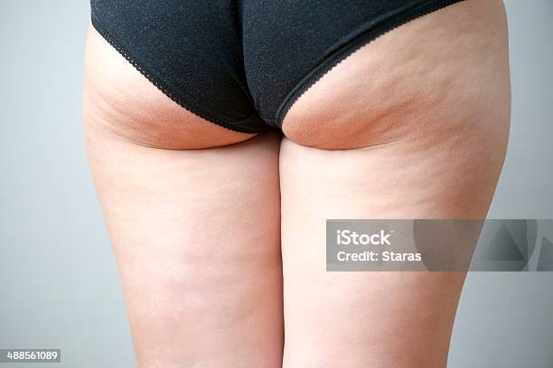 Fatty Female Hips Stock Photo - Download Image Now - Cellulite, Buttocks, Women