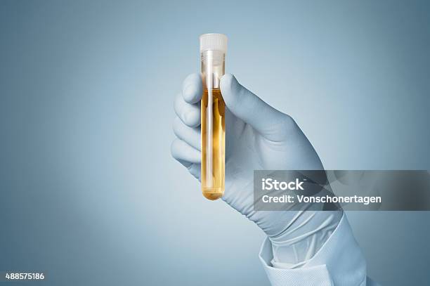 의사의 손으로 소변 검체 소변에 대한 스톡 사진 및 기타 이미지 - 소변, 소변 샘플, 약물 검사 - iStock 의사의 손으로 소변 검체 소변에 대한 스톡 사진 및 기타 이미지 - 소변, 소변 샘플, 약물 검사 - Istock